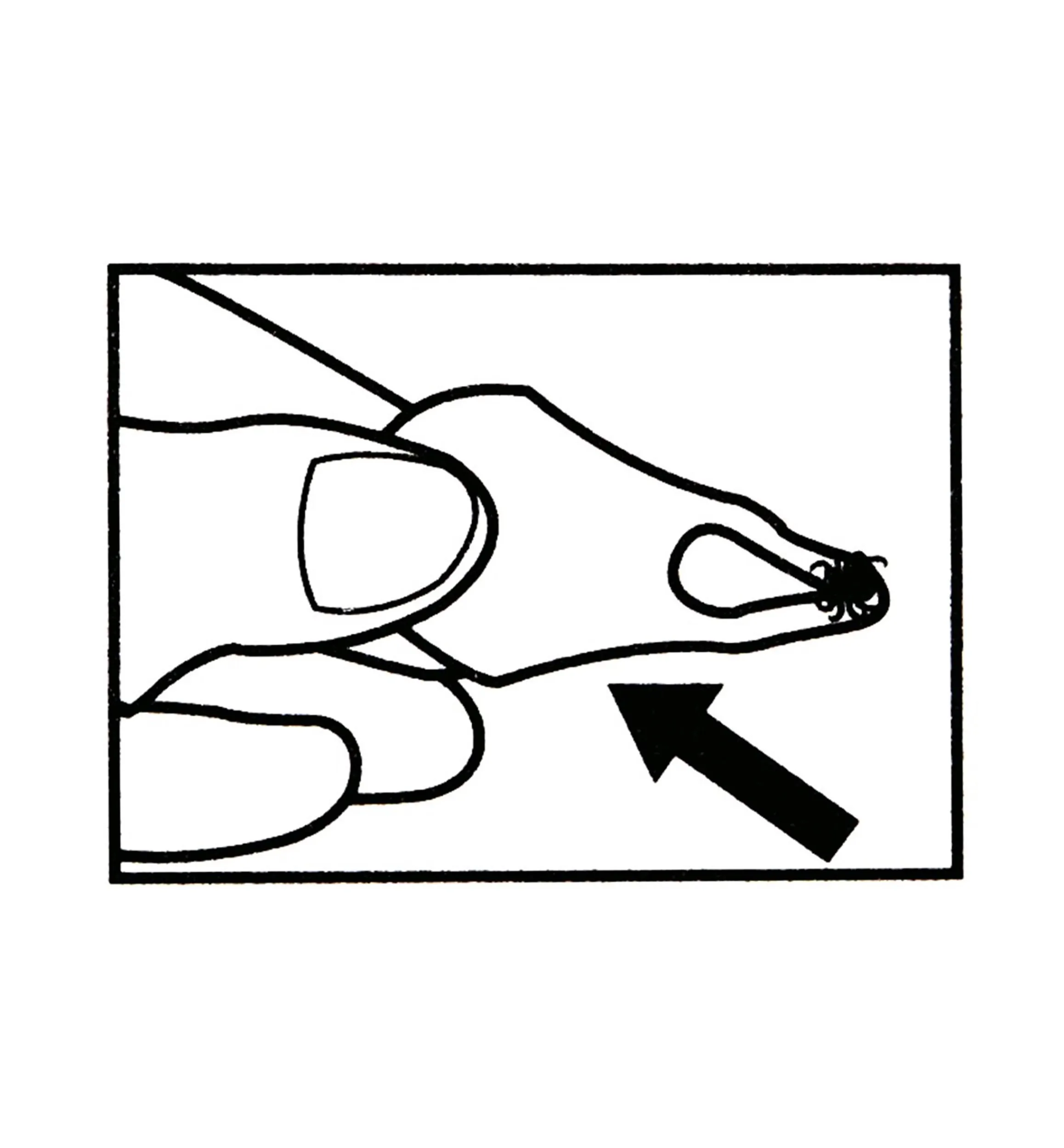 Lee Valley Pest Control>Set Of 3 Tick Key Tick Removers